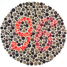 Ishihara test plate-25. Normal person will see it as 96 while person with Protanopia or protanomaly will see it as 6 and patient with Deuteranopia or deuteranomaly will see it as 9