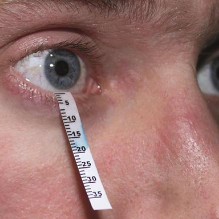 Diagnosis of Dry Eyes. schirmer test can be used to diagnosis Dry Eyes